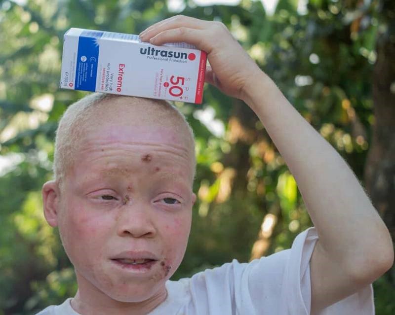 Teenager with first bottle of sunscreen